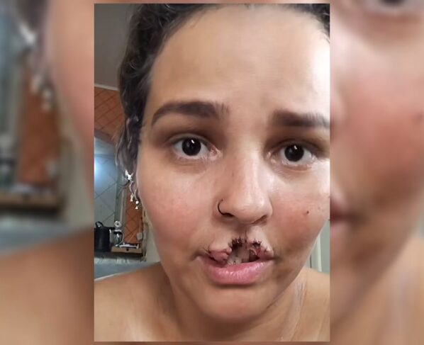 técnica de enfermagem Natani Santos, de 35 anos